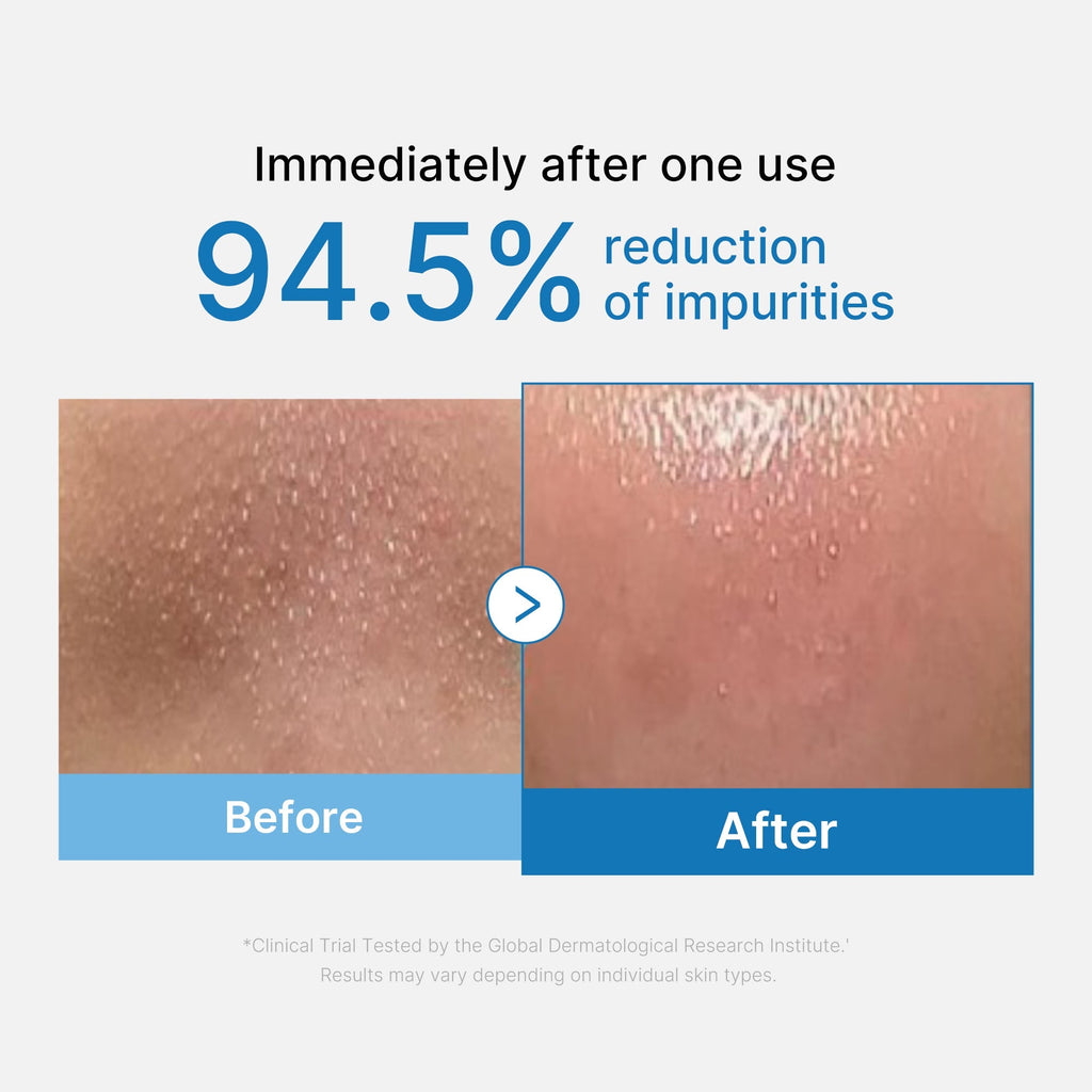 Huile Démaquillante Anti-Points Noirs Zero Pore – visuel 2