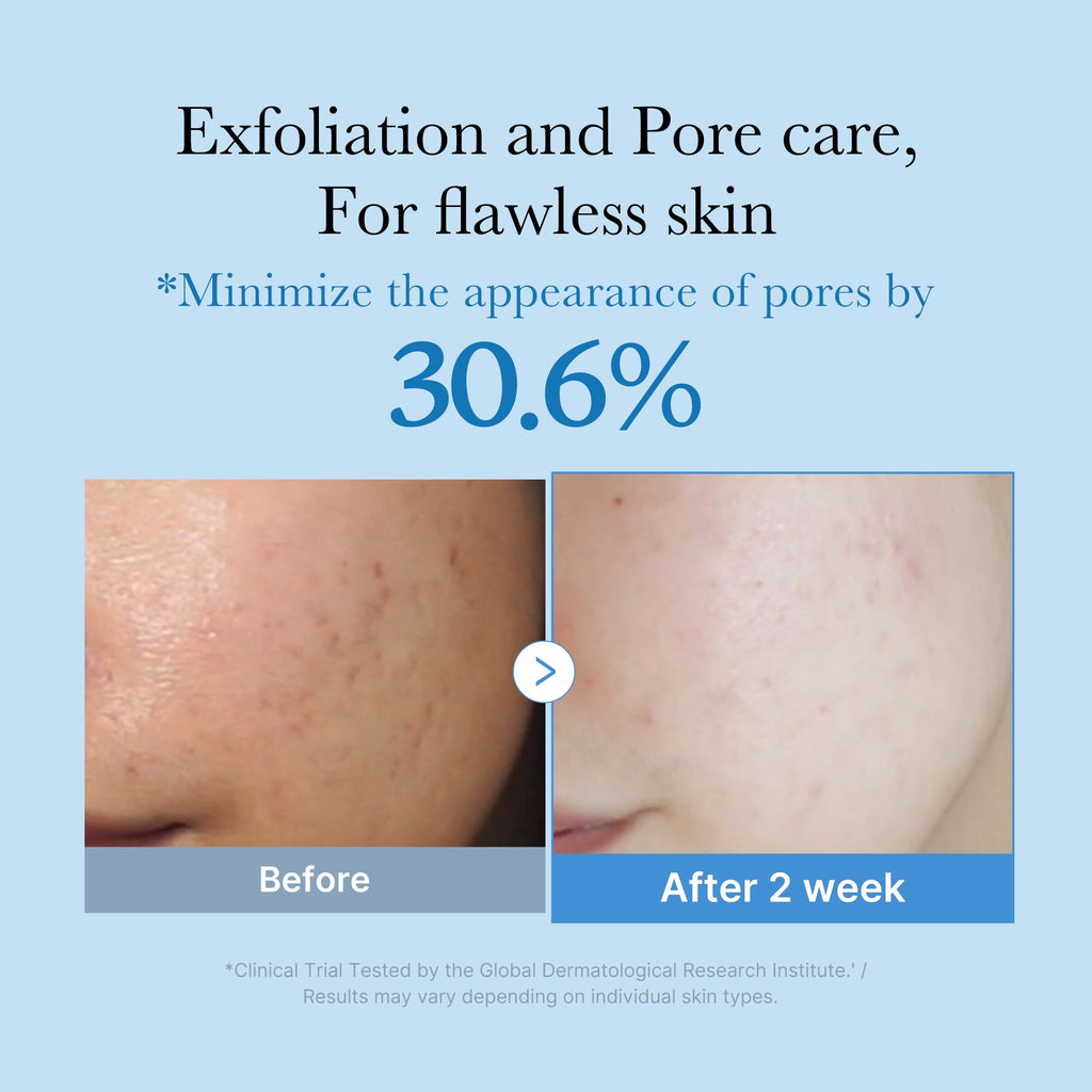 Lotion Tonique Zero Pore – visuel 2