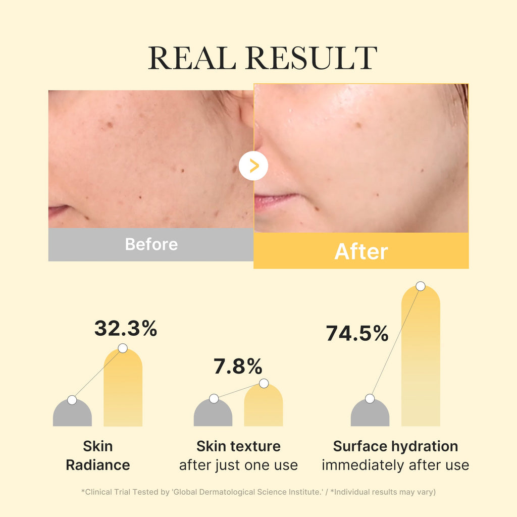 Masque Gel Jelly Gold Acide Kojique & Curcuma – visuel 3