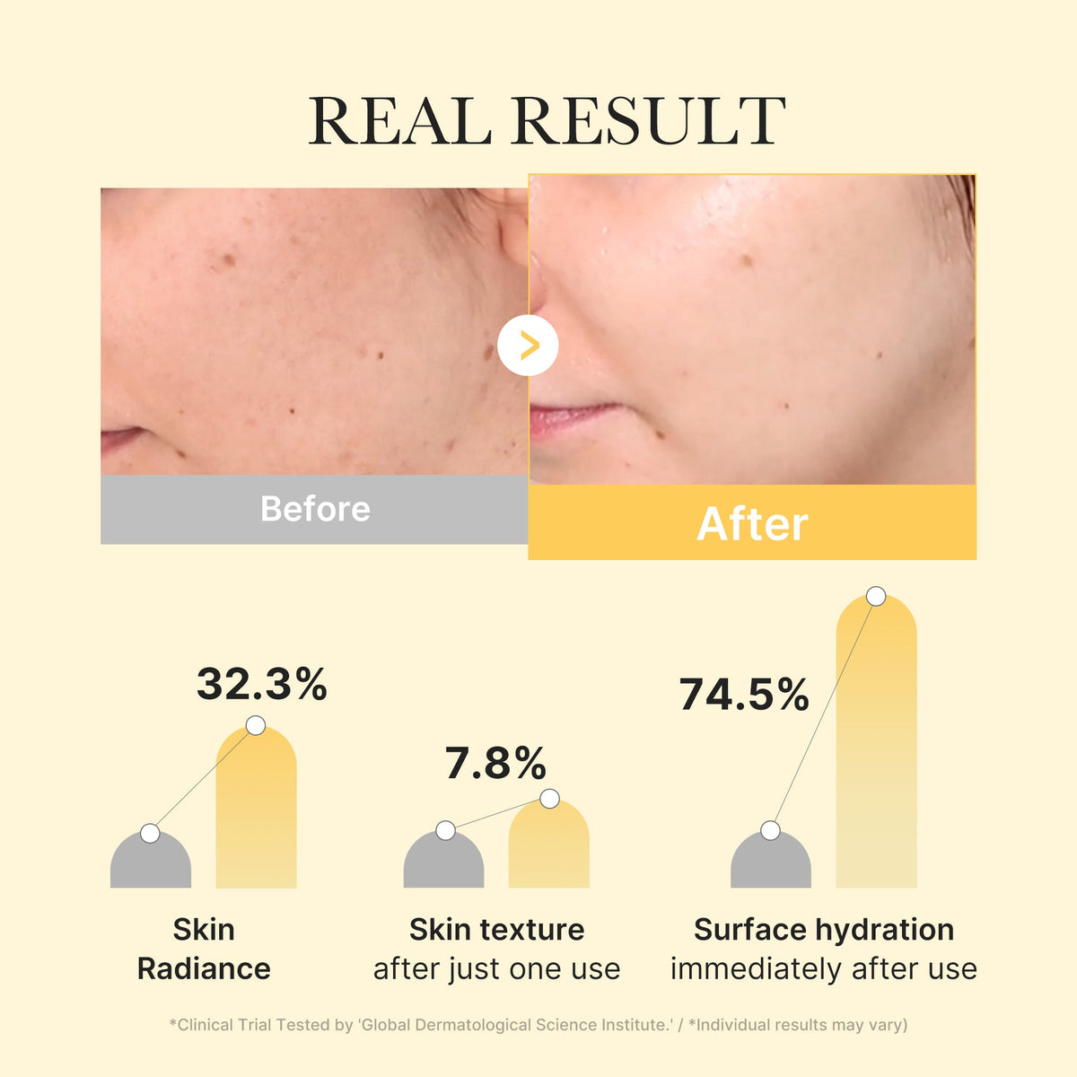 Masque Gel Jelly Gold Acide Kojique & Curcuma – visuel 3