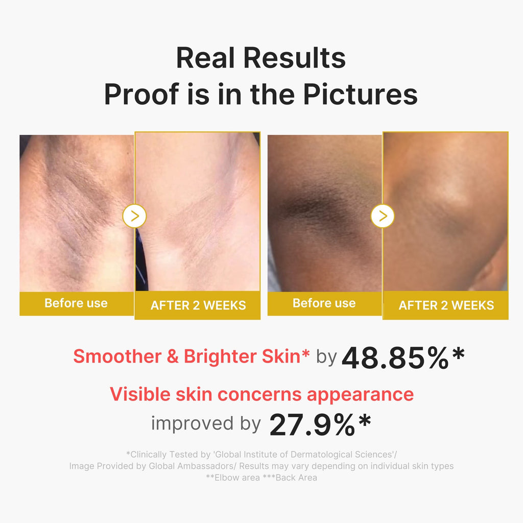 Peel Shot Corps Acide Kojique & Curcuma – visuel 3