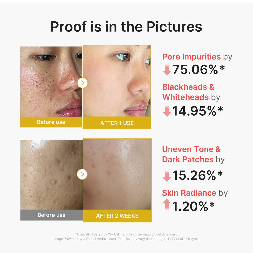 Peel Shot Acide Kojique & Curcuma – visuel 3