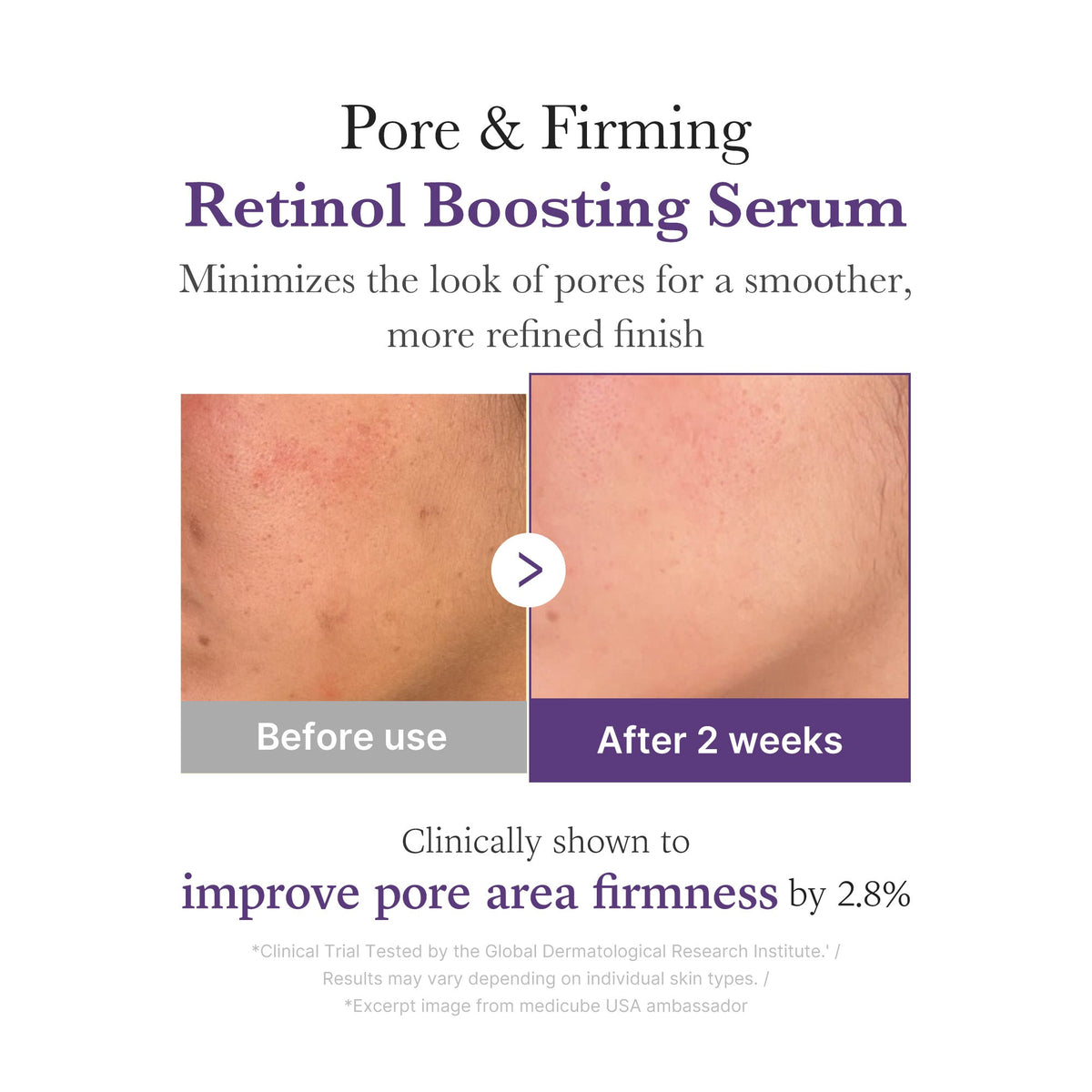 Sérum Booster Rétinol NMN – visuel 4