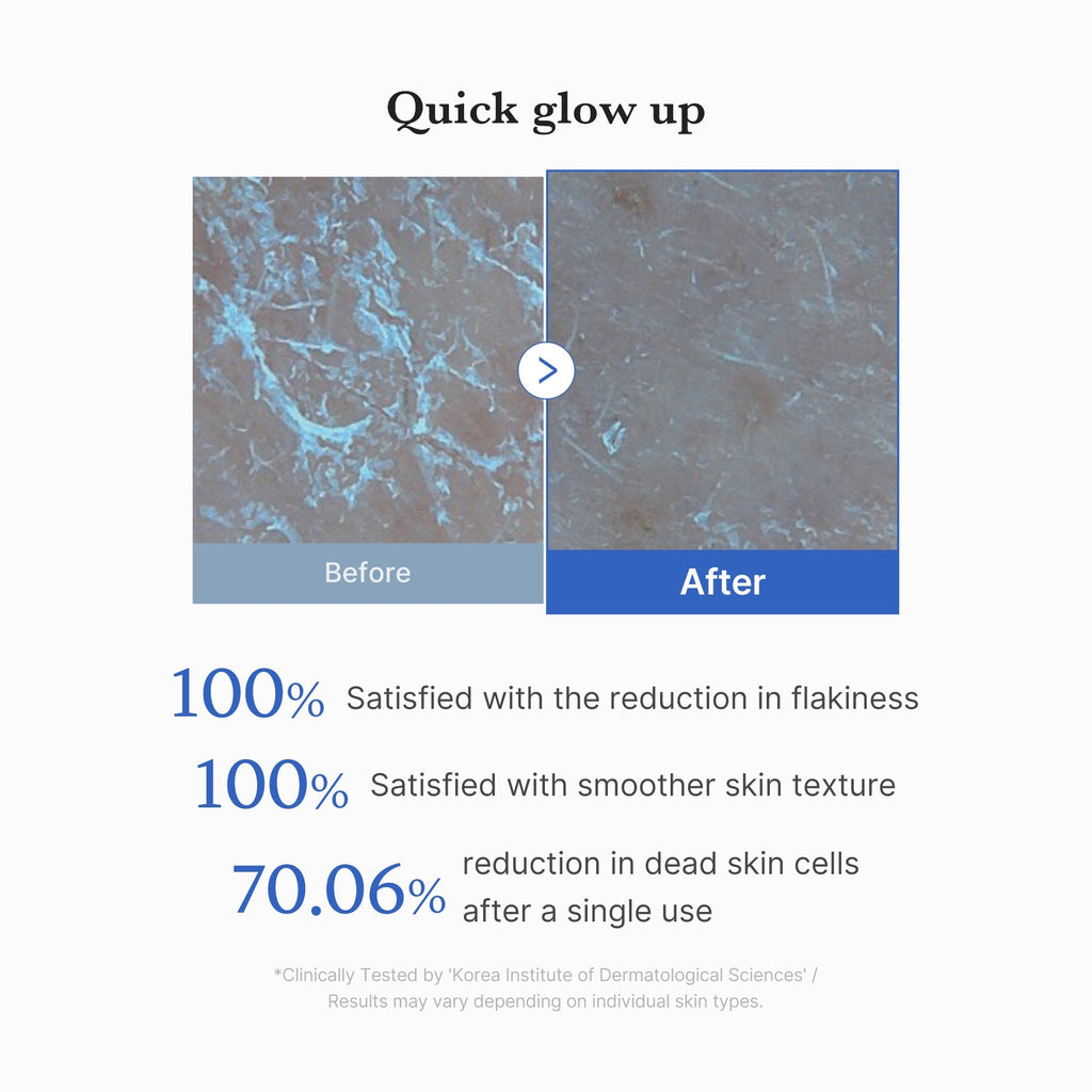 Disques Peeling Zero Pore (×8) – visuel 4