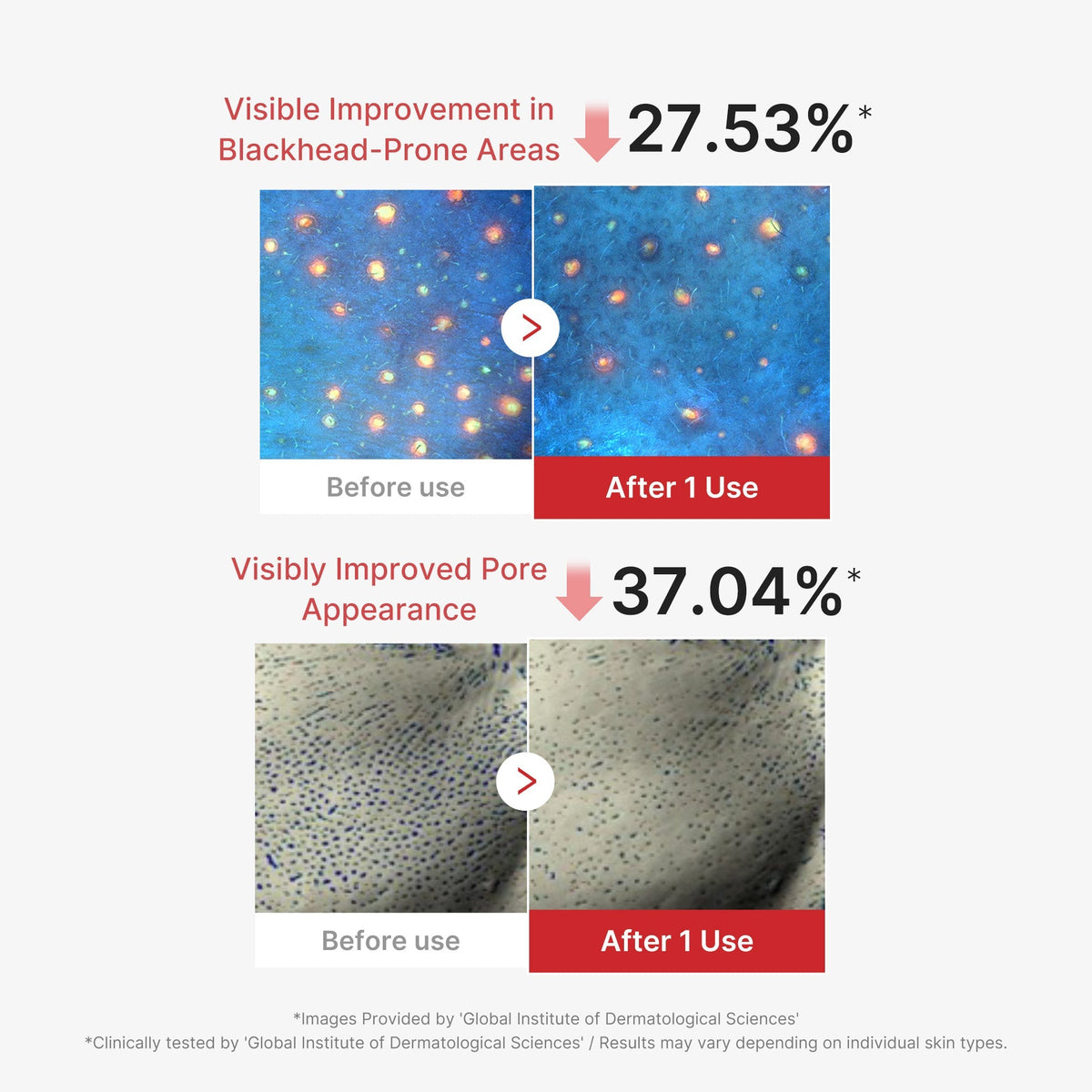 Masque Peeling Acide Hypochloreux – visuel 4