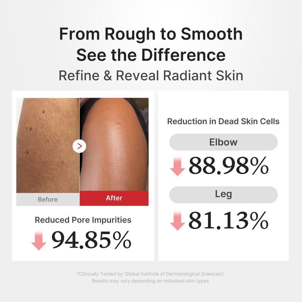 Peel Shot Corps au Riz Acide Hypochloreux – visuel 4