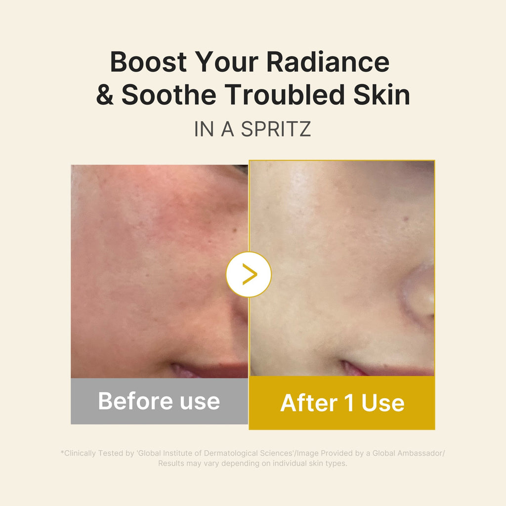Sérum-Brume Jelly Gold Vitaminé Acide Kojique & Curcuma – visuel 4
