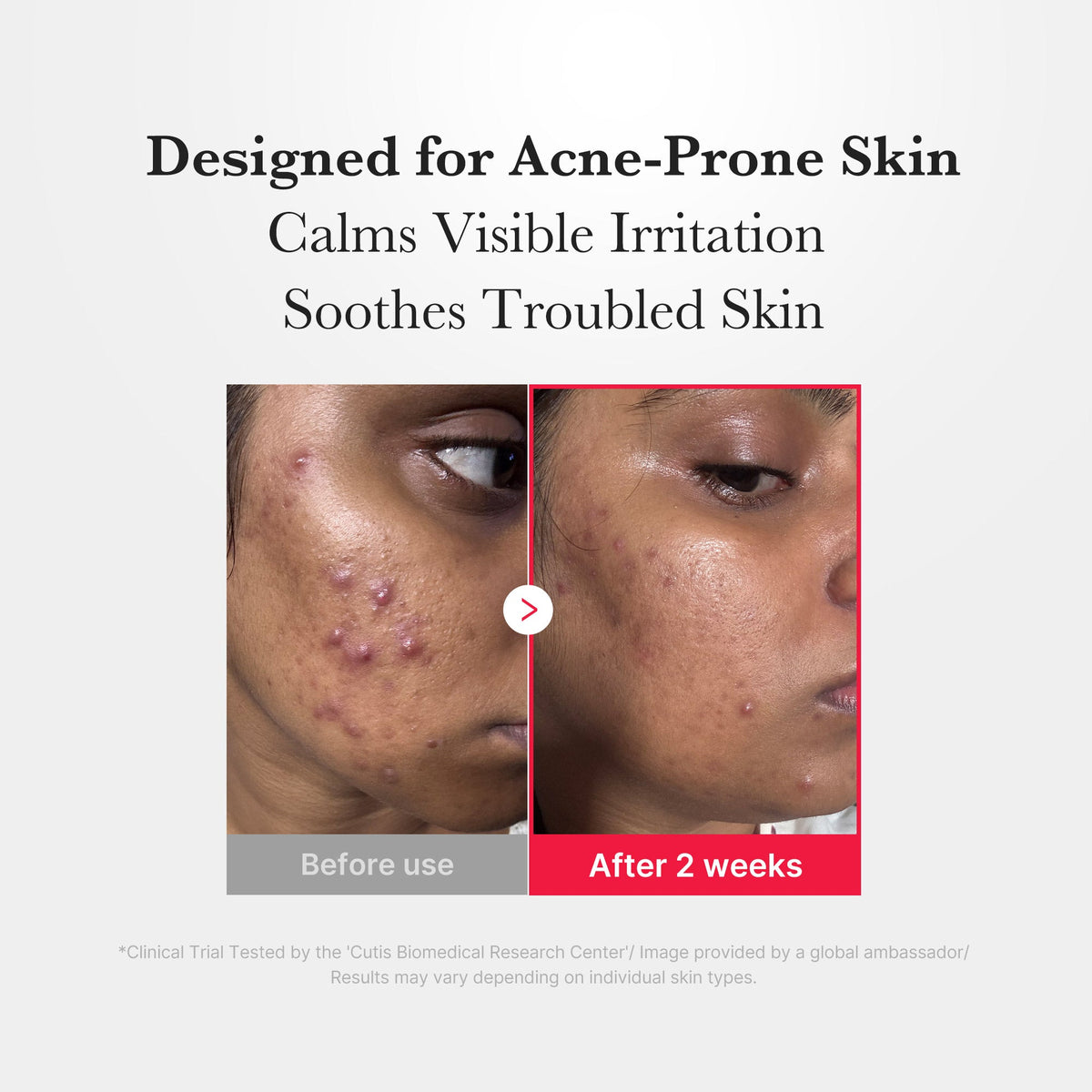 Spray Apaisant Intense Acide Hypochloreux – visuel 5