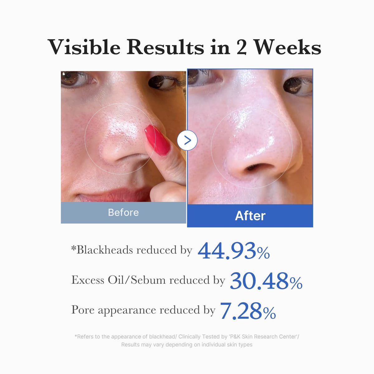 Disques Zero Pore – visuel 5