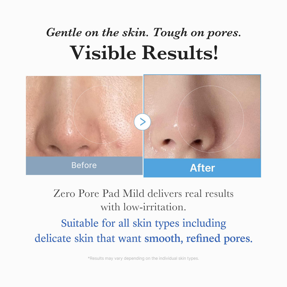 Disques Madécassoside Zero Pore (Doux) – visuel 5