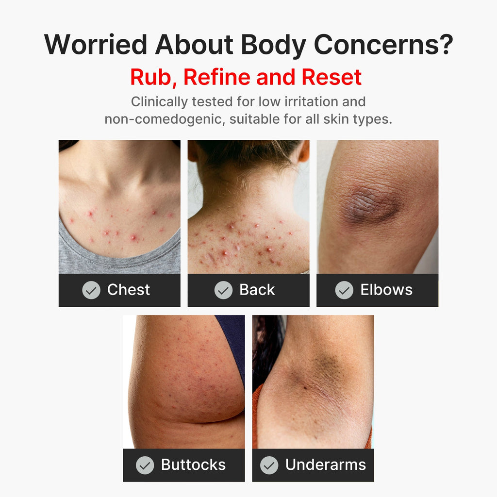Peel Shot Corps Acide Kojique & Curcuma – visuel 5