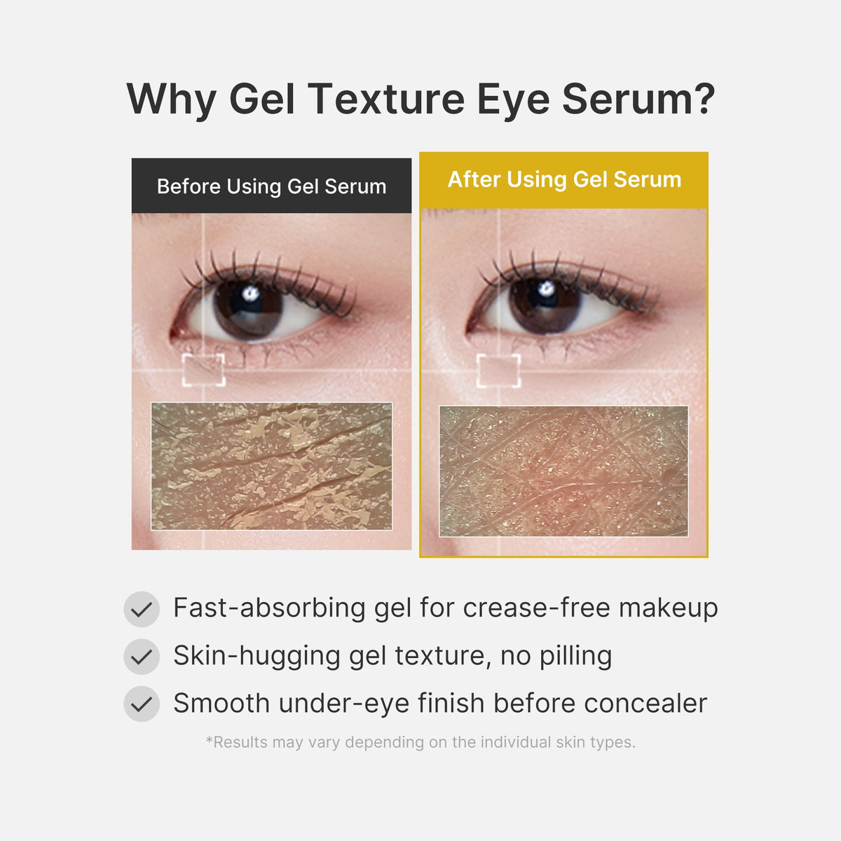 Sérum-Gel Contour des Yeux Acide Kojique & Curcuma – visuel 6