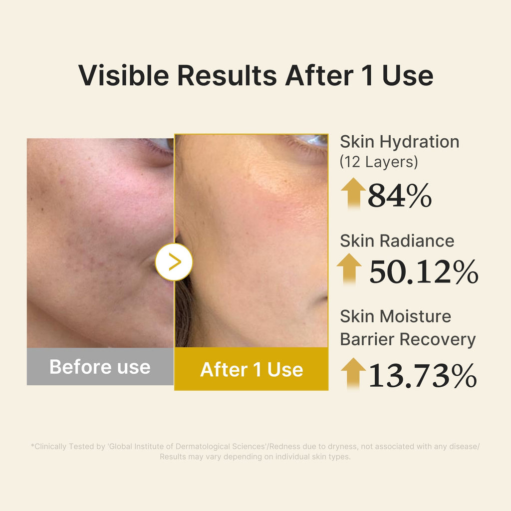 Sérum-Brume Jelly Gold Vitaminé Acide Kojique & Curcuma – visuel 5