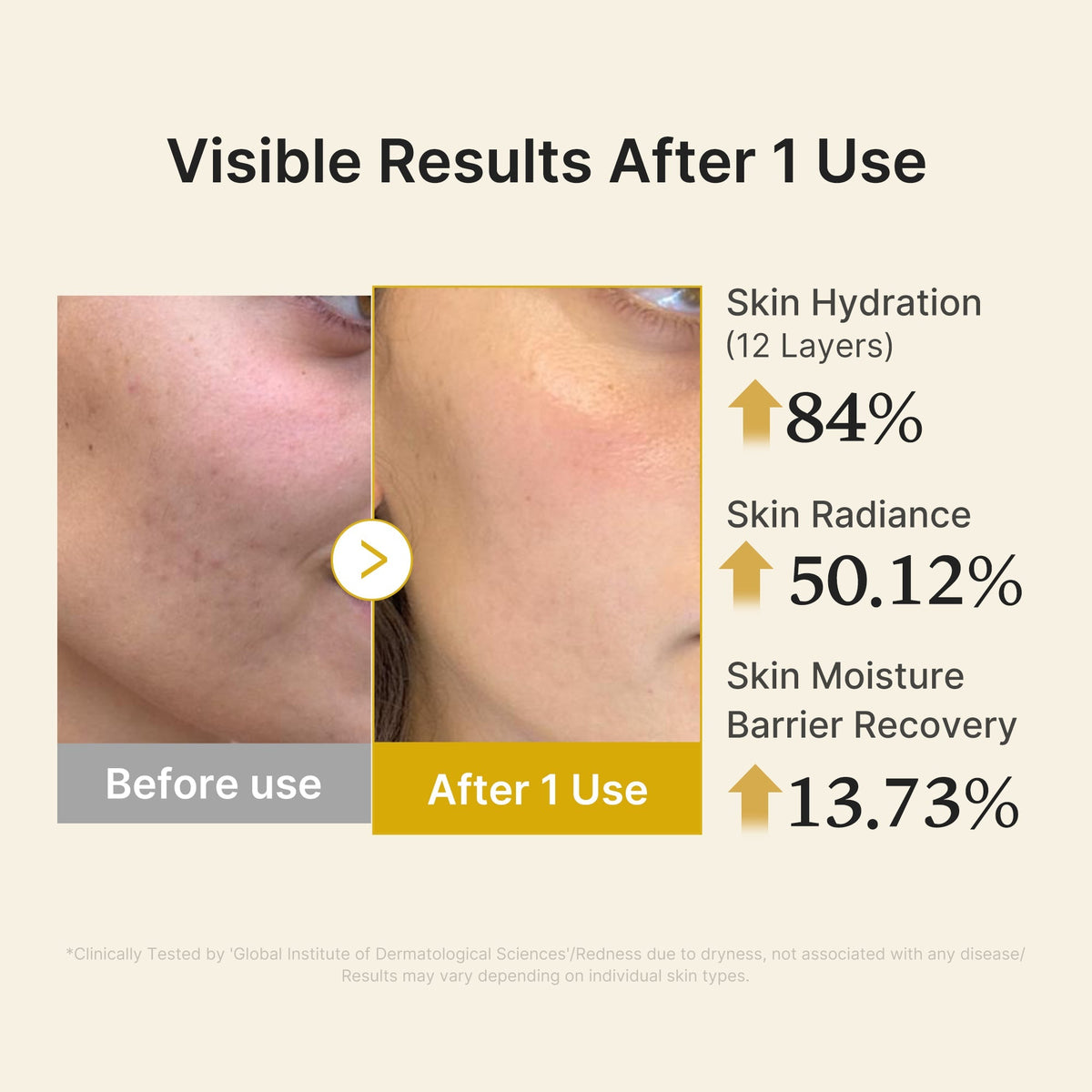 Sérum-Brume Jelly Gold Vitaminé Acide Kojique & Curcuma – visuel 5