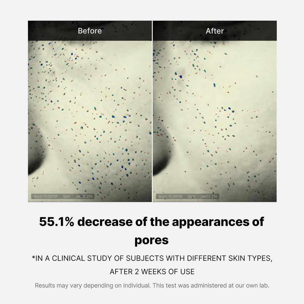 Duo Soin des Pores – visuel 10