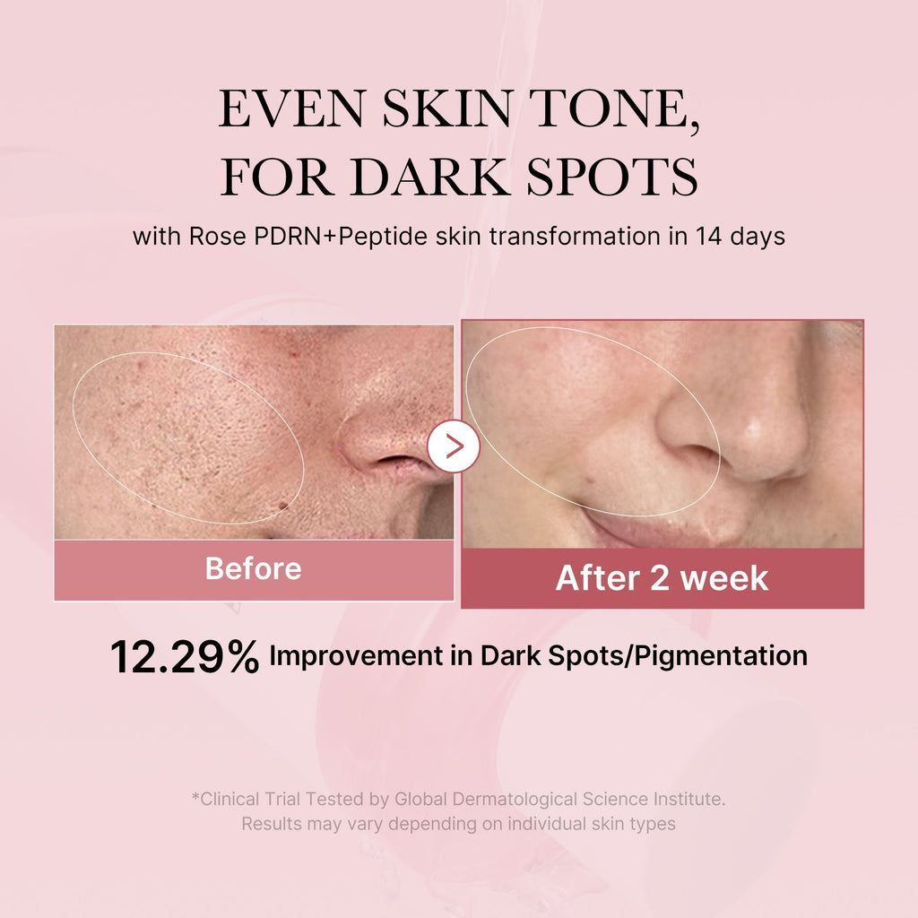 Lotion Tonique PDRN Pink Peptide – visuel 2