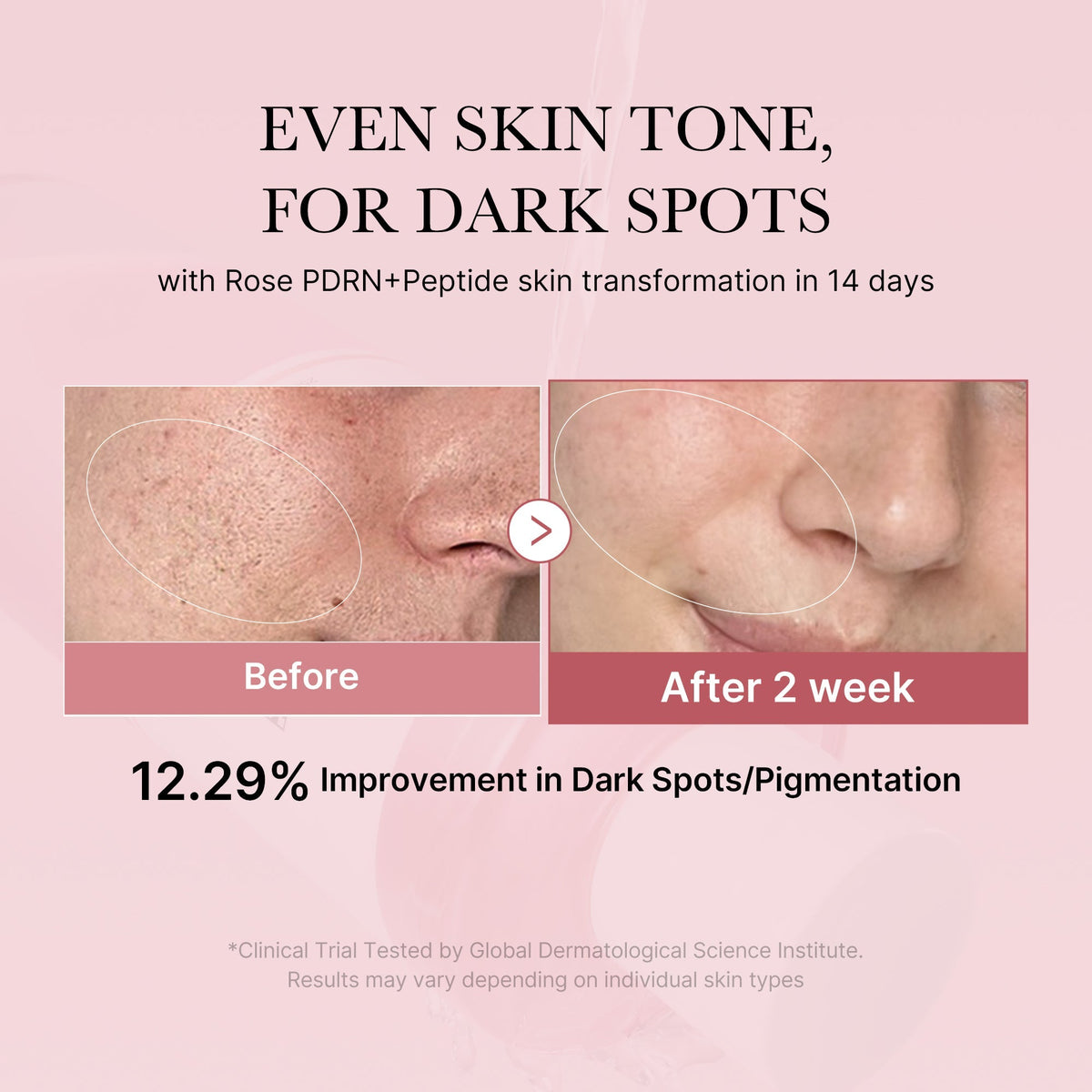 Lotion Tonique PDRN Pink Peptide – visuel 2