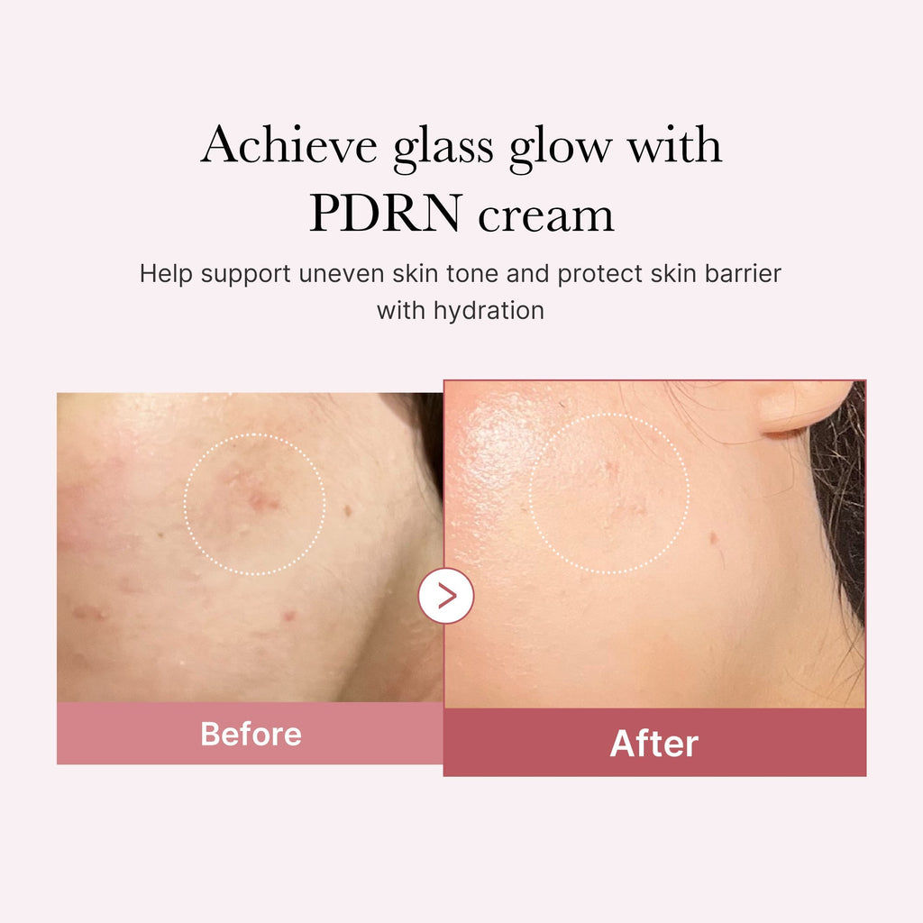 Crème PDRN Pink Peptide – visuel 3