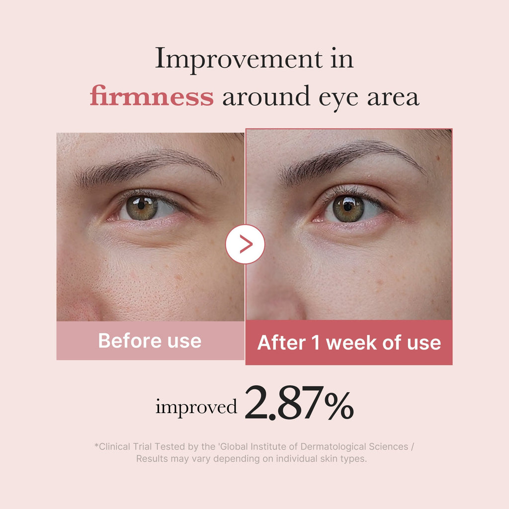 Crème Contour des Yeux PDRN Pink Peptide – visuel 4