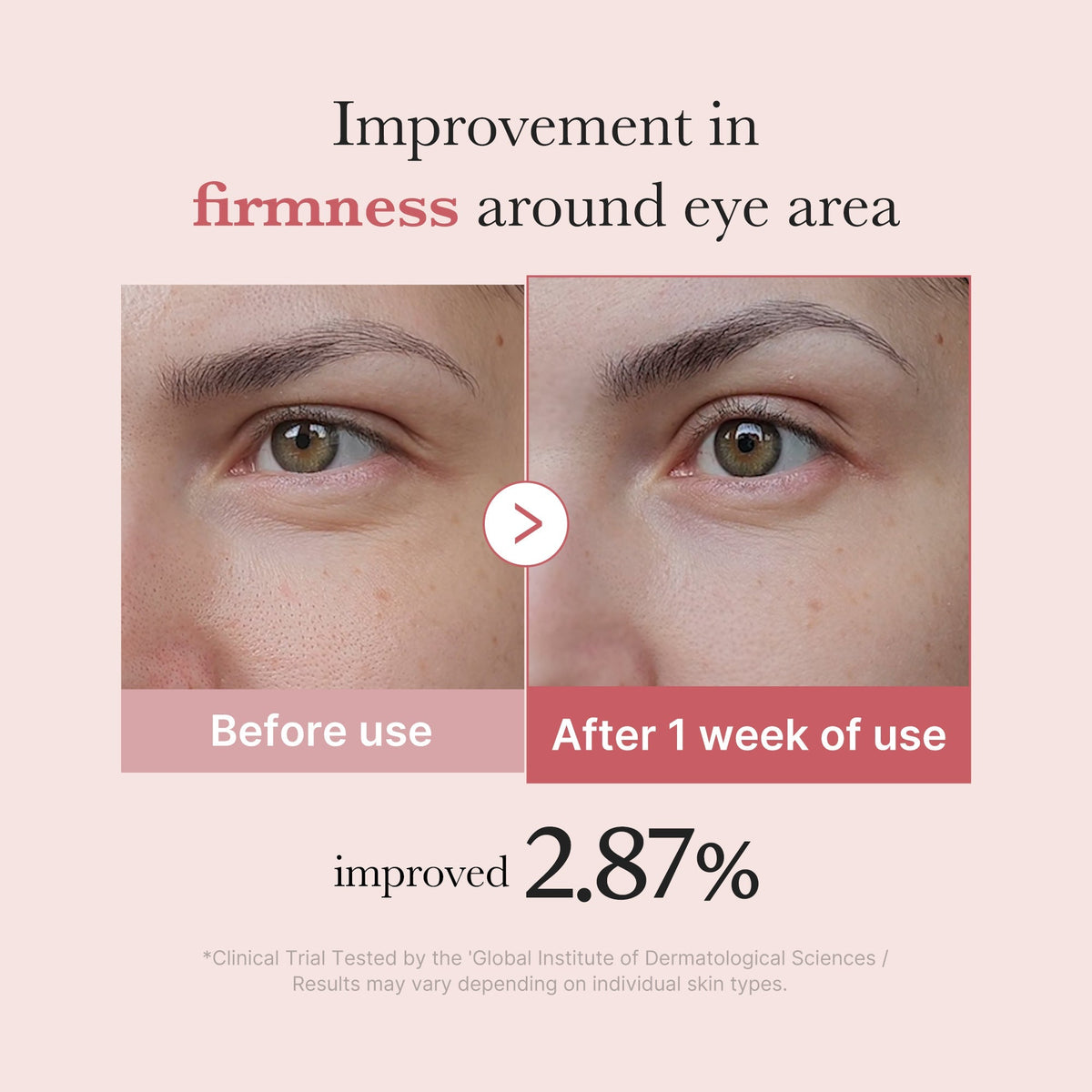 Crème Contour des Yeux PDRN Pink Peptide – visuel 4