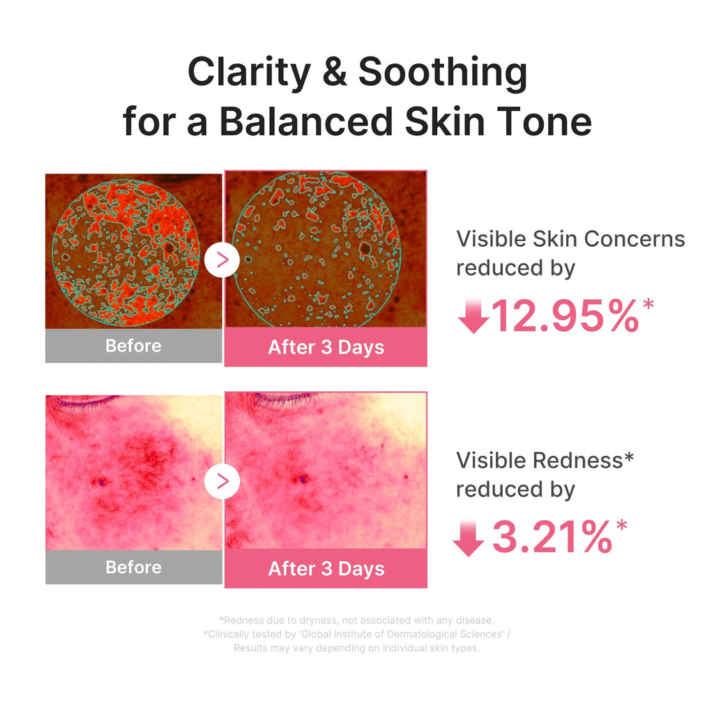 Sérum Ultra Léger PDRN Pink Peptide – visuel 4