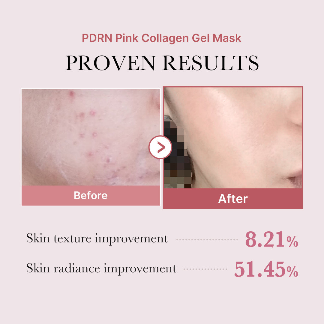 Coffret Complet PDRN Pink Glow – visuel 6