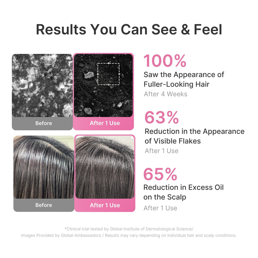 Shampooing Densifiant Rafraîchissant Romarin PDRN – visuel 5