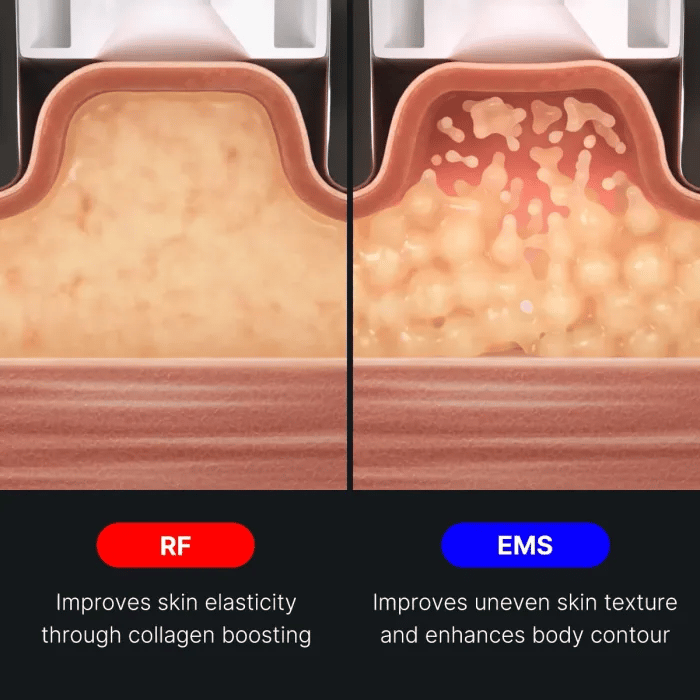 AGE-R Contour Body Shot – visuel 5